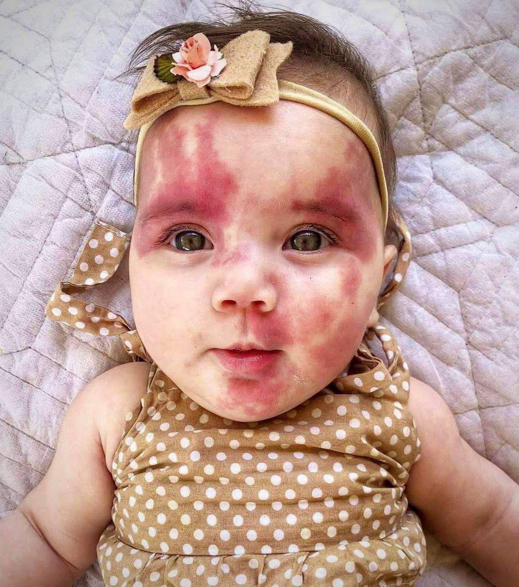 Baby called ‘hideous’ is a gorgeous little girl now