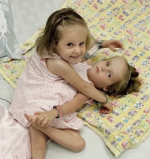 These girls were born as siamese twins, but were successfully separated at the age of four in 2006.Now they are already 18