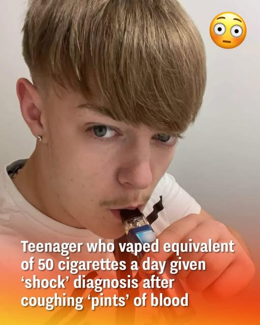 Teenager vaping the equivalent of 50 cigarettes a day receives shocking diagnosis after coughing up ‘pints’ of blood