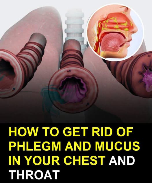 How To Get Rid Of Phlegm And Mucus In Your Throat And Chest On Your Own